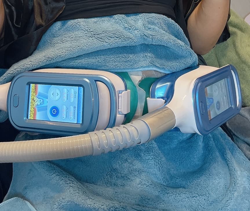 価格が値下‼️多機能な脂肪冷却 痩身マシン