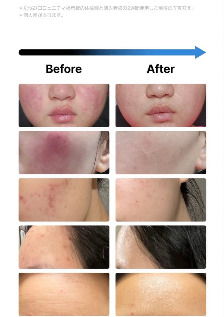 【美品】Glow.m 美顔器 ブースターソニック BOOSTERSONIC 韓国