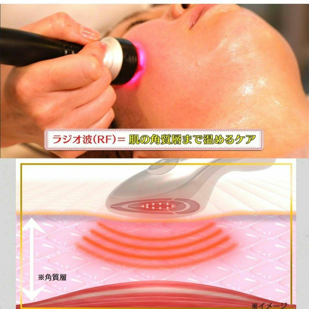 IKKO プロデュース ME ラボン エクラ ／ エレクトロポレーションエステ