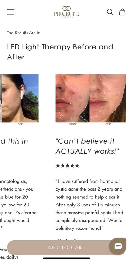 Project E Beauty Photon LEDマスク美顔器