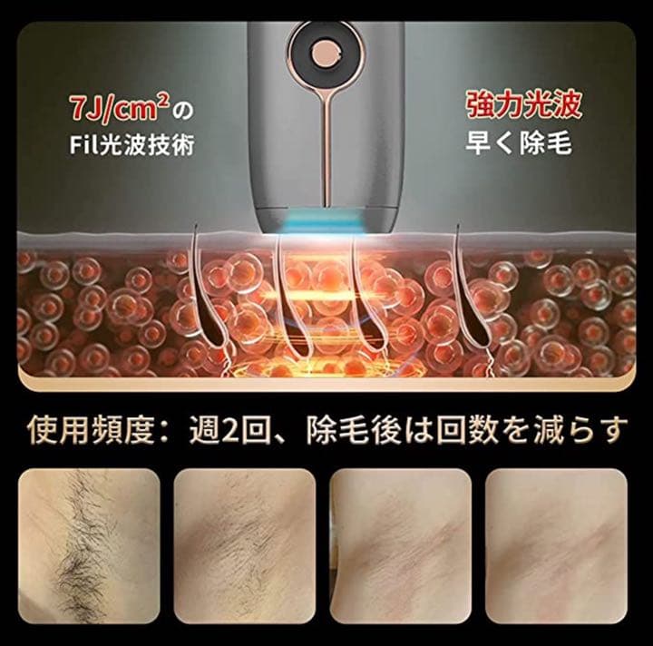 ☆【新品•未使用】照射回数100万回♪VIO対応♪男女兼用光脱毛器　冷却付き☆