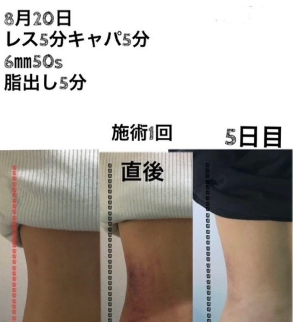 インディバ
