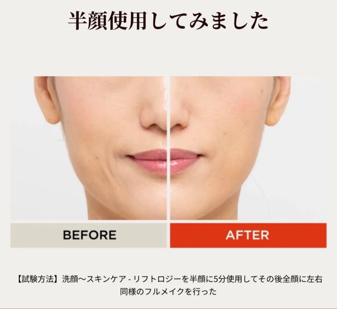 ほぼ新品❣️ヤーマンリフトケア特化型美顔器 リフトロジー YJFD1N ゴールド