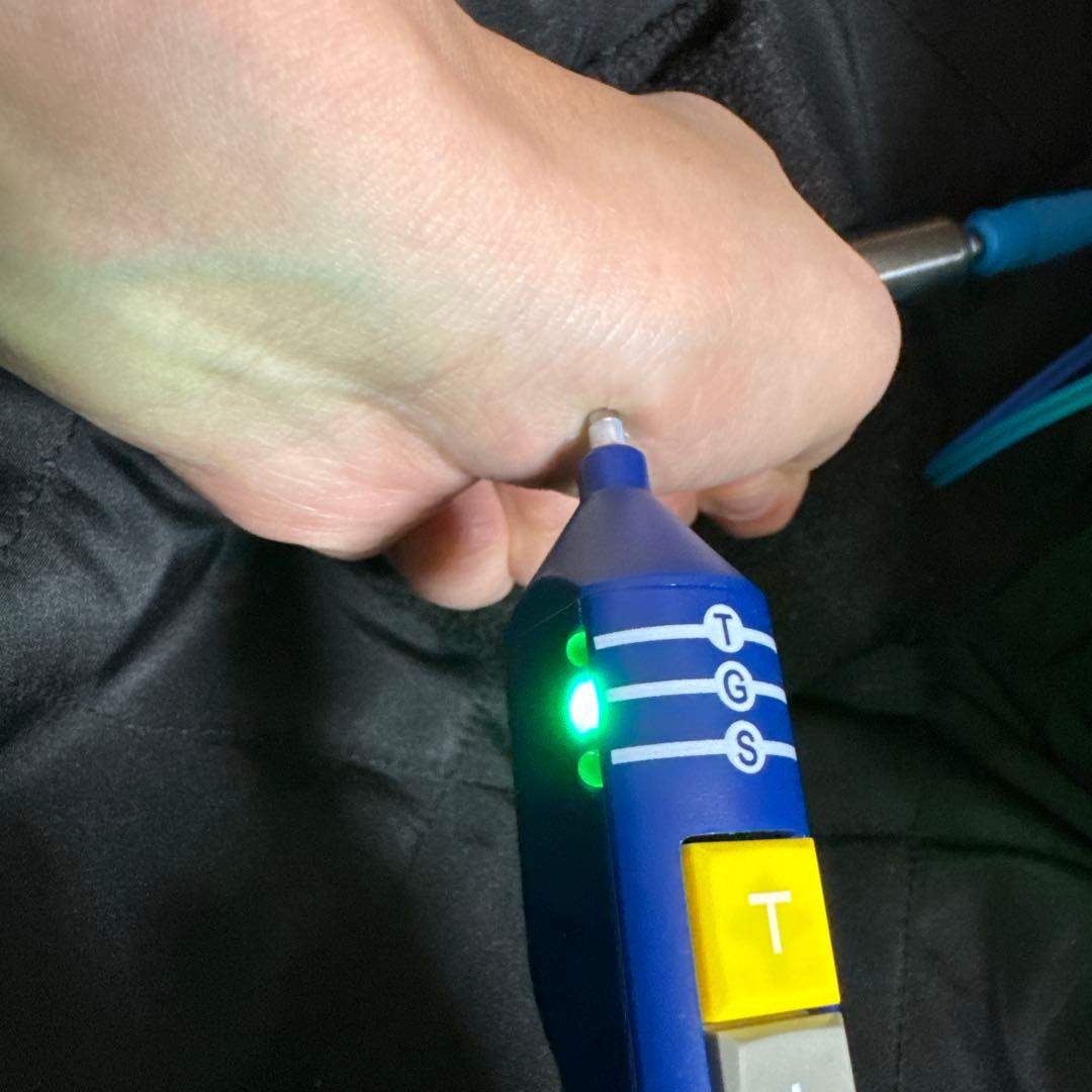 オリキュロセラピー 耳ツボ Point select digital 耳介療法